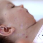 Foto: 180 raste me fruth në Kosovë, tetë të reja vetëm këtë javë